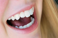 �Ser mujer influye en los problemas dentales?