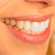 Truco para hacer lucir tus dientes m�s blancos