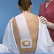 Los tatuajes lumbares y la epidural 